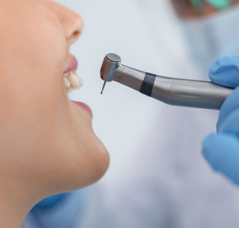 Diş Lezyonu Nedir, Nasıl Tedavi Edilir?