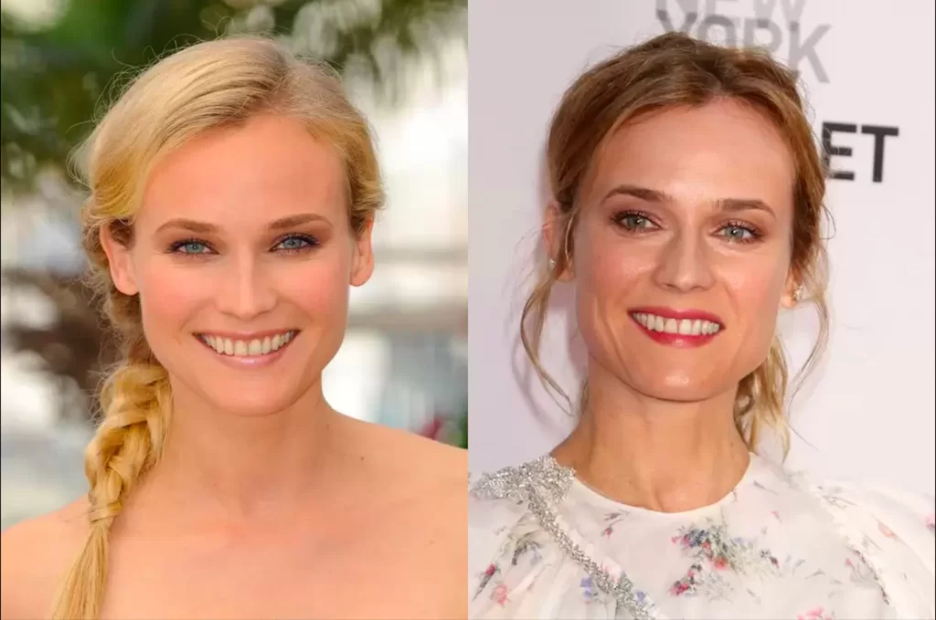 Dislerini-Yaptiran-Unluler-Diane-Kruger