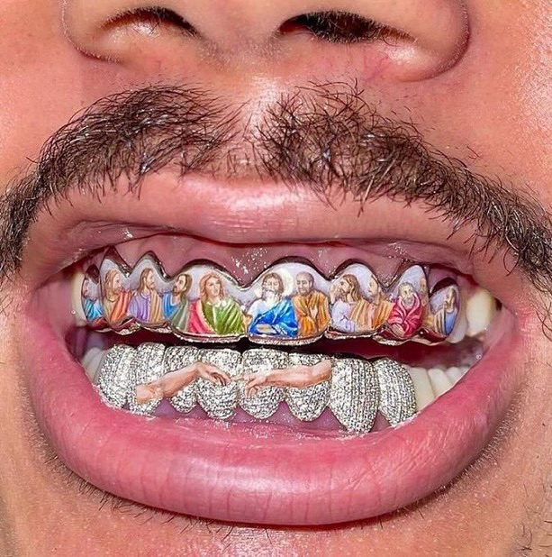 Grillz Nedir? Diş Grillz Fiyatları, Custom Grillz ve Gümüş-Altın Grillz