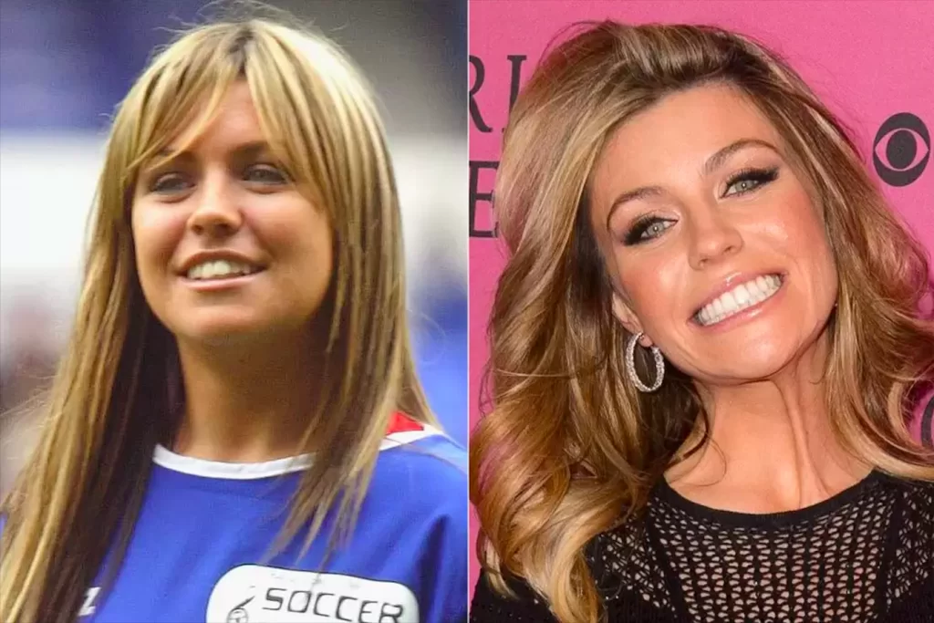 Unlulerin-Disleri-Abbey-Clancy