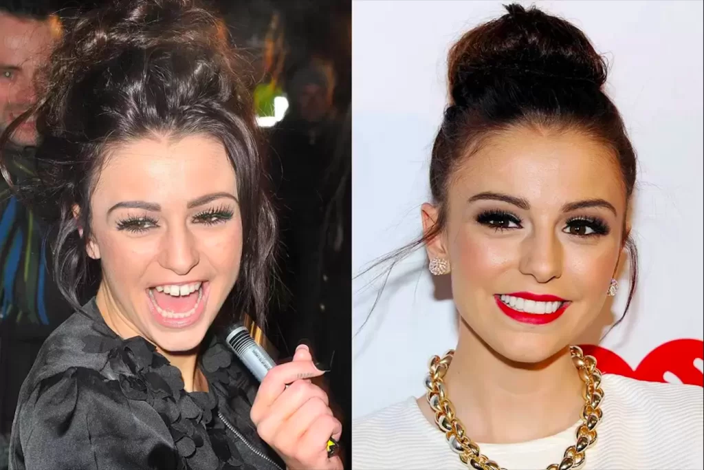 Unlulerin-Disleri-Cher-Lloyd