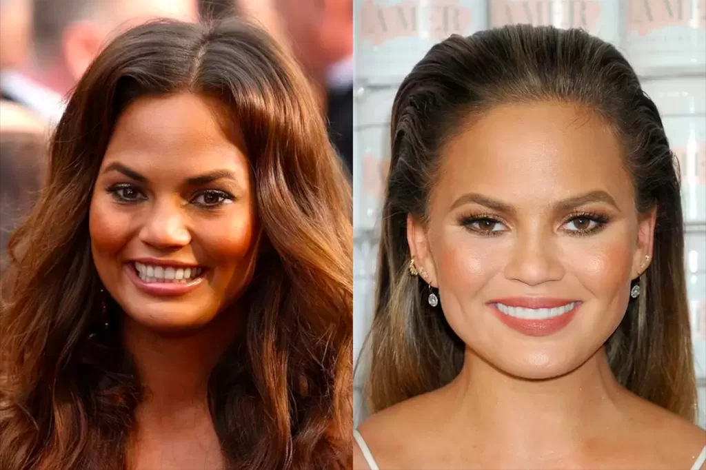 Unlulerin-Disleri-Chrissy-Teigen-