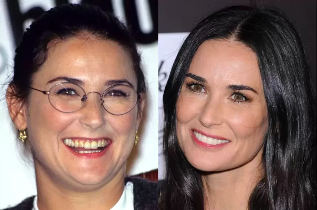 Unlulerin-Disleri-Demi-Moore