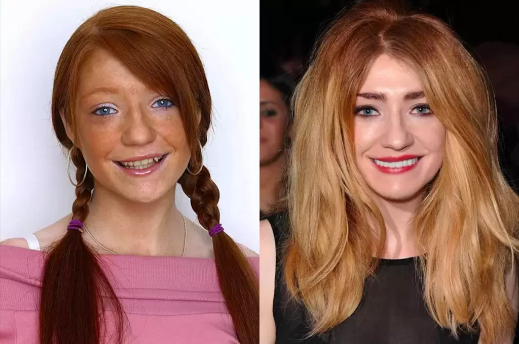 Ünlülerin Dişleri Nicola-Roberts