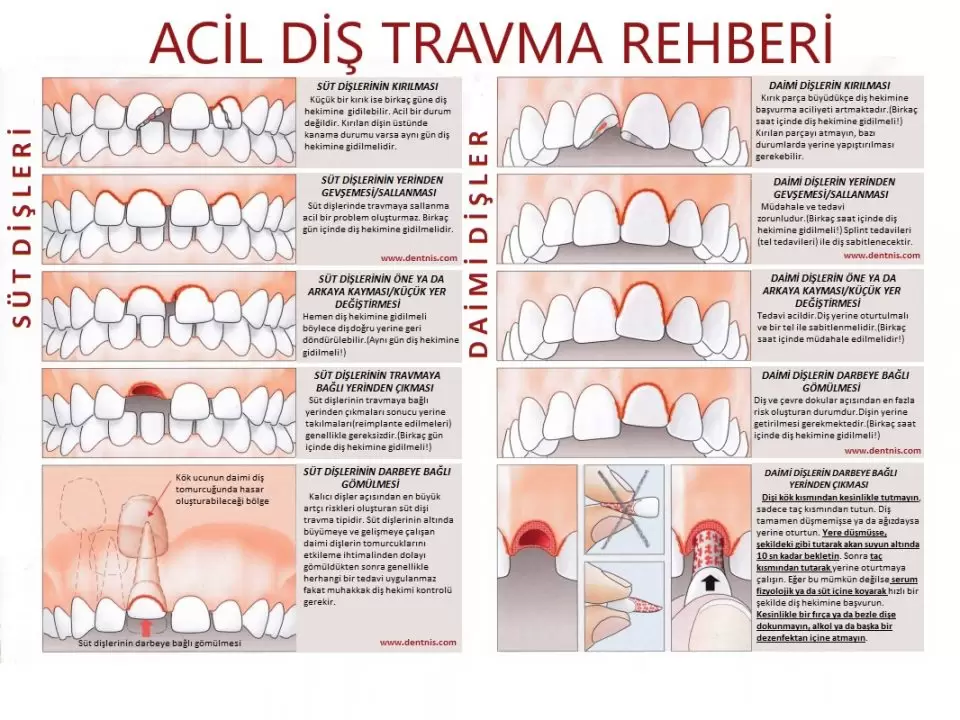 Acil Diş Travma Rehberi